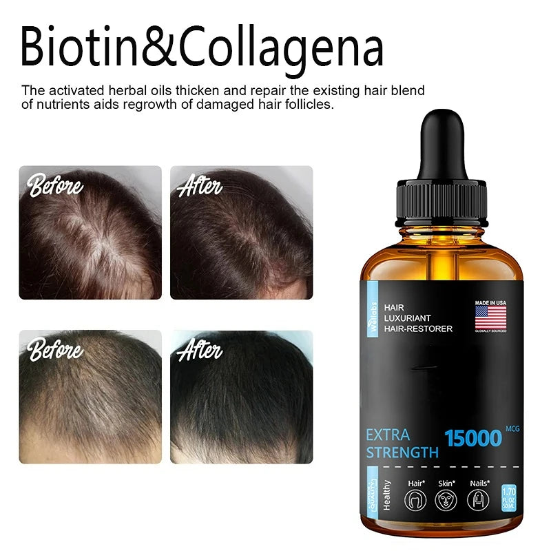 Hair Growth Essential oils Products Ginger Essence Fast Regrowth Serum Beard Growth Oil Hair Loss Care Beauty Scalp Treatment