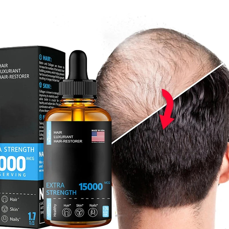 Hair Growth Essential oils Products Ginger Essence Fast Regrowth Serum Beard Growth Oil Hair Loss Care Beauty Scalp Treatment